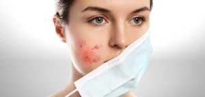 علاج الوردية