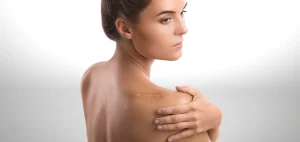 علاج الندبات