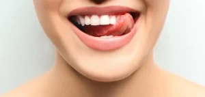 Sonrisa de Hollywood