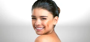 Esthétique des Fossettes