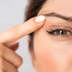 Göz Kapağı Düşüklüğü Nedir? Neden Olur?